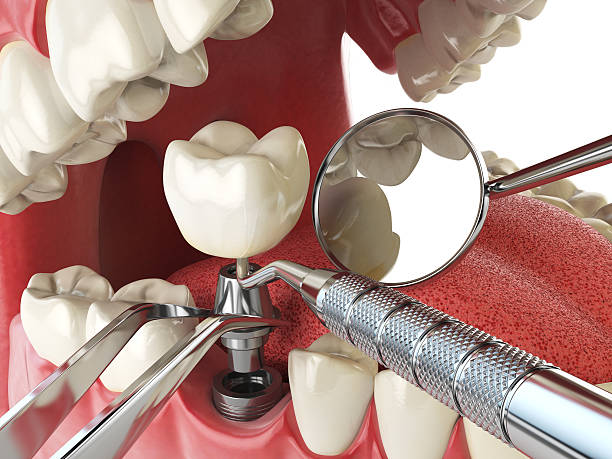 Best Emergency Dentist for Knocked-Out Tooth in Sierra View, PA